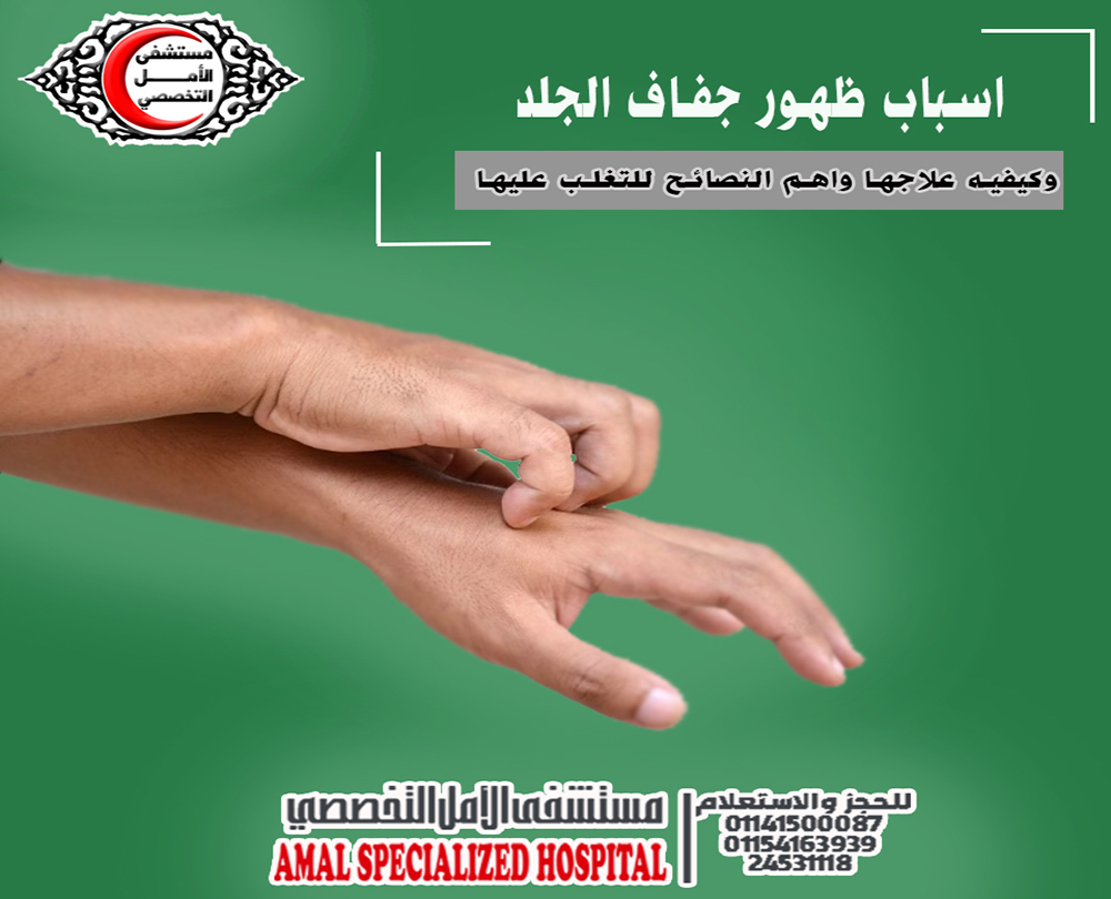  جفاف الجلد 